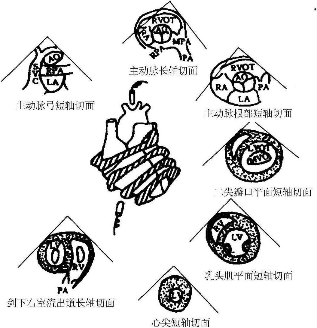 第四節(jié) 超聲診斷技術(shù)的臨床應(yīng)用